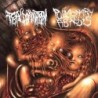PULMONARY FIBROSIS / FETAL DOMINATION - Split - CD